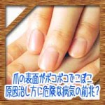 爪の表面がボコボコでこぼこ！原因治し方に危険な病気の前兆？